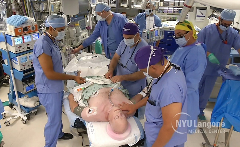 В Нью-Йоркском университете проведена самая сложная в мире операция по пересадке лица
