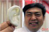 Китайские врачи успешно пересадили пациенту «выращенное» на руке ухо