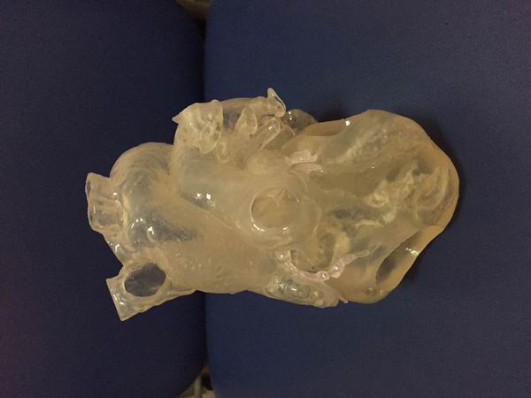 3D-печать спасает детей с заболеваниями сердца