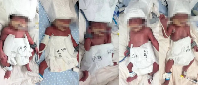 Китаянка родила пятерню